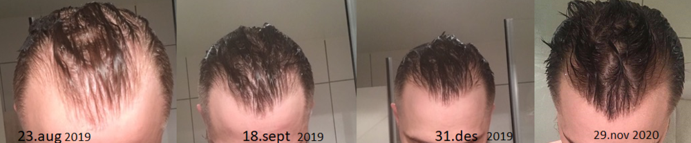 New progression wet.png