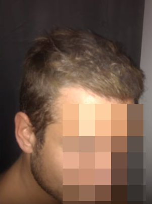 NnQKxT6.png