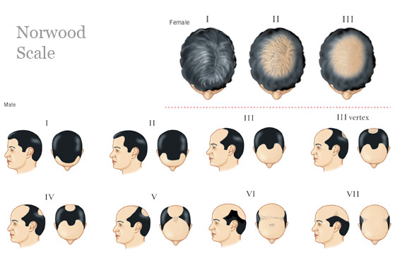 Norwood-Scale.jpg