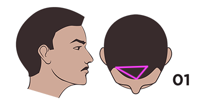 norwood-scale-nw2.png