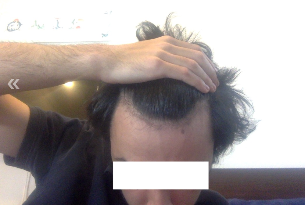 ORr1Esz.png