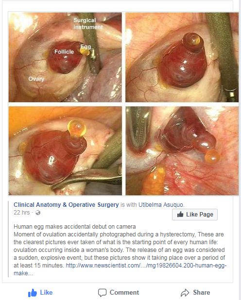Ovary.JPG