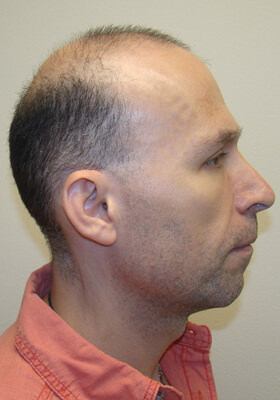 p86_right_before.jpg