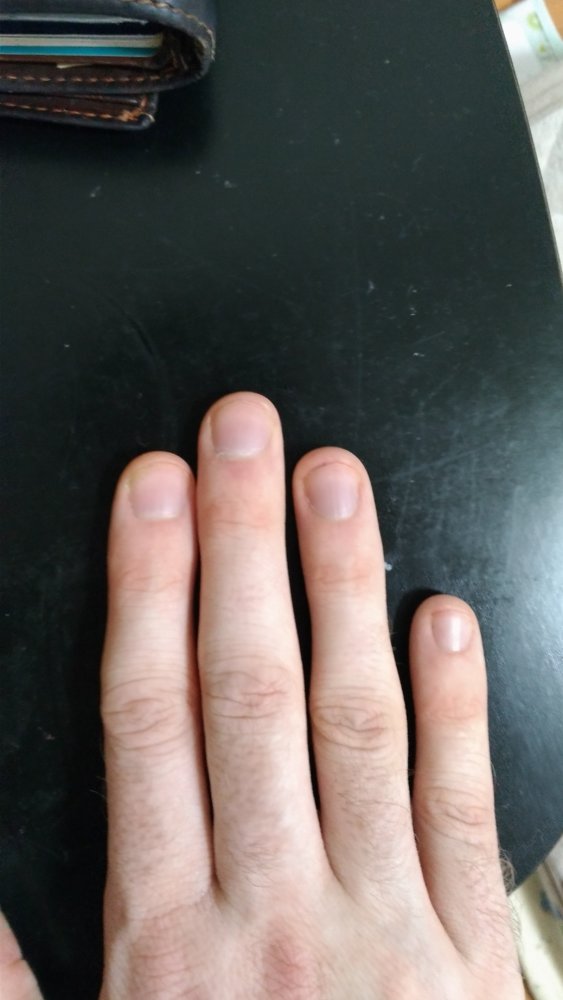 P_20180702_180823_vHDR_Auto.jpg