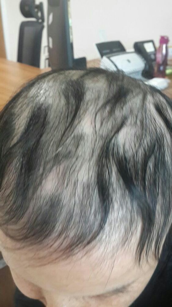 Picture-1-after.jpg