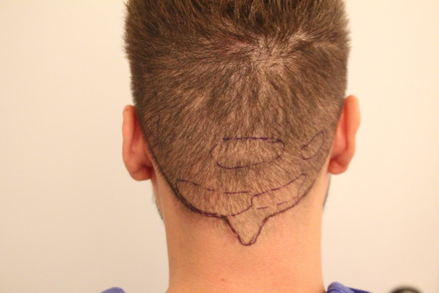 PRE-OP-CENTER.jpg
