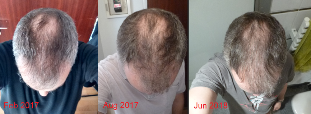 progression.png