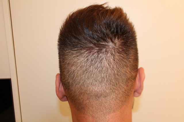 result-6-months.jpg