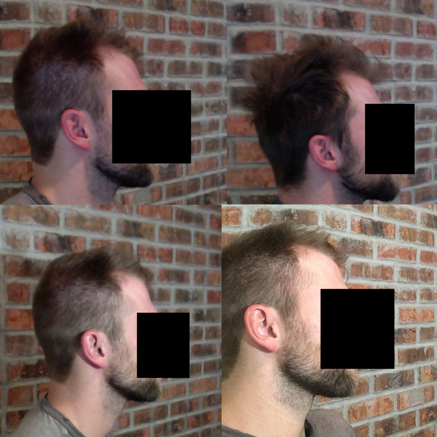 Right Side.jpg