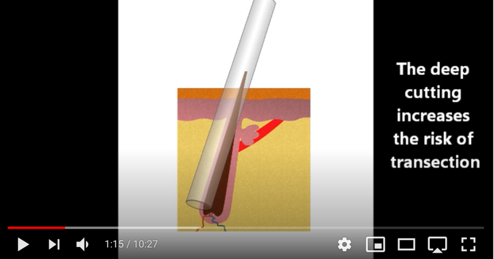 rmatic1.thumb.png.0814b1746db1555bf246d8ccc2d9ee26.png
