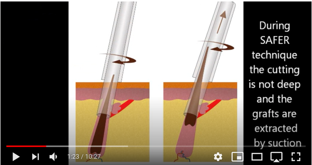 rmatic2.thumb.png.0a2e5fa13b362b8de40dcc3955f37487.png