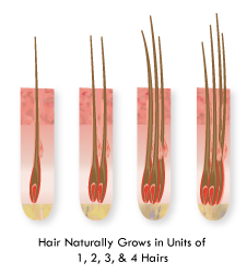 scalp-illustration4.png