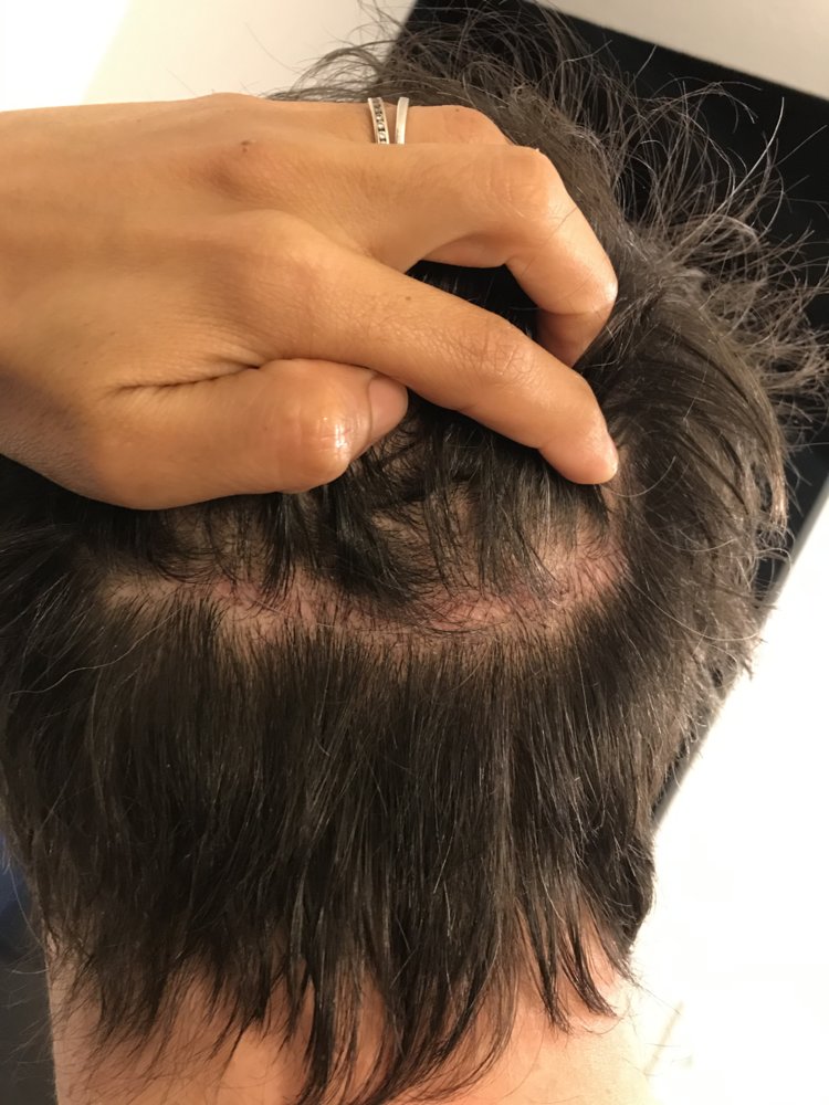 Scar.JPG