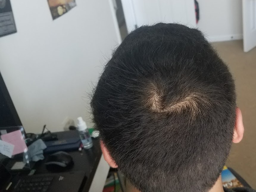 short1.jpg