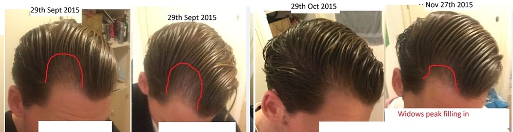 SideOfHead-Nov_zpsdtyof1ix.jpg