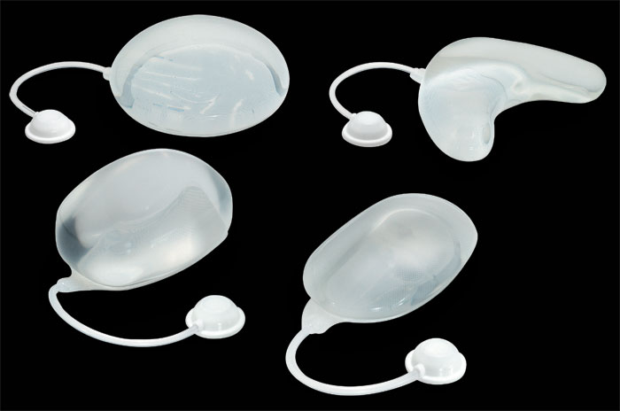 tissue-expander-1.jpg