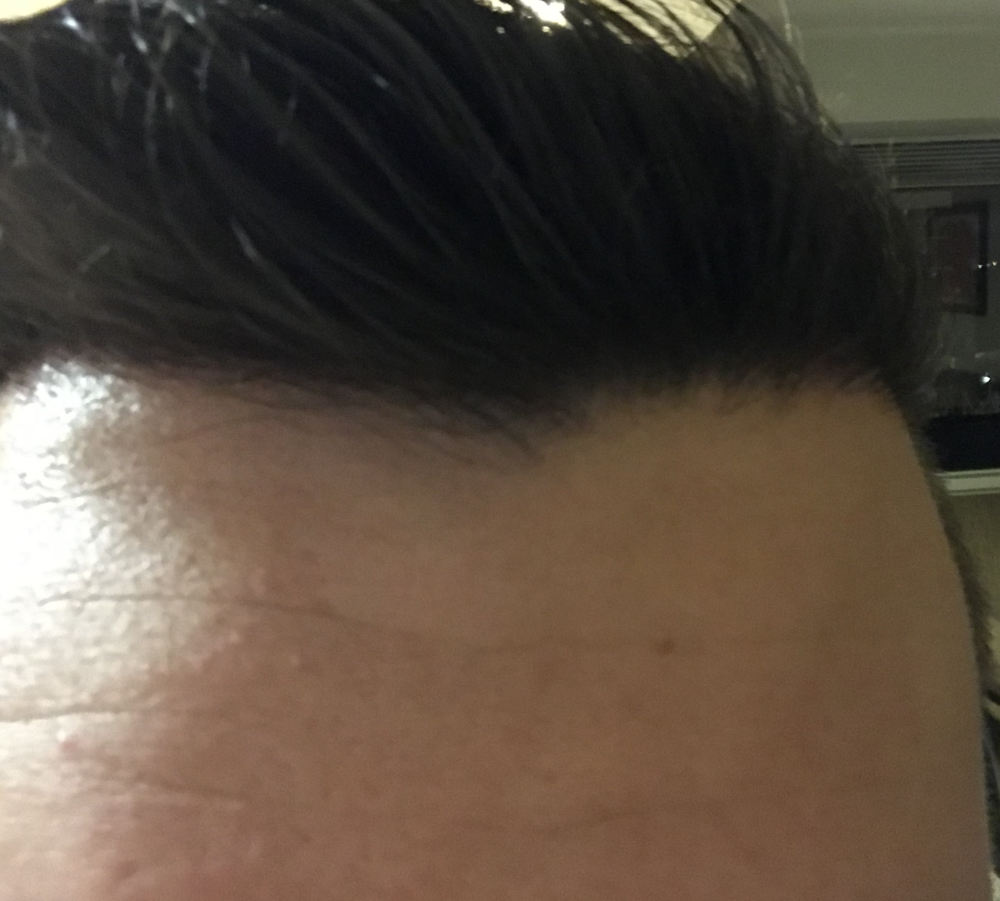 TP3_3months_front.png
