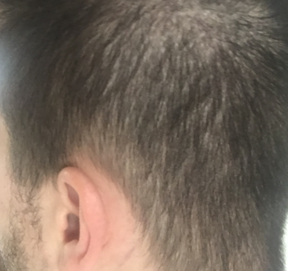 TP3_backleft_1month.png