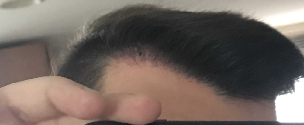 TP3_RightSide1_1month.png