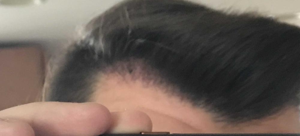TP3_RightSide2_1month.png
