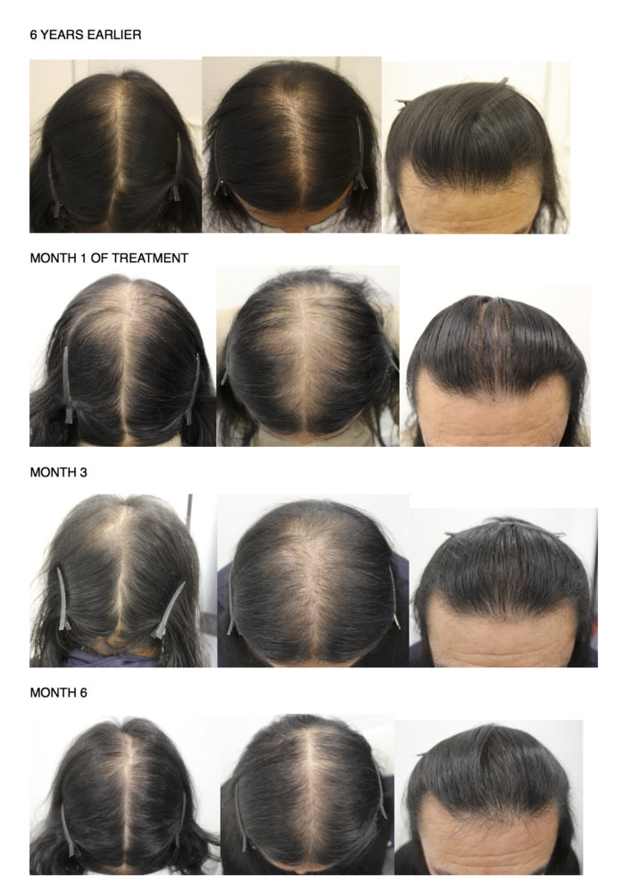 TRESSES 2.jpg