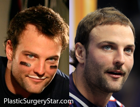 welker.jpg