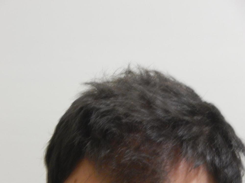 WJDbv6p.jpg