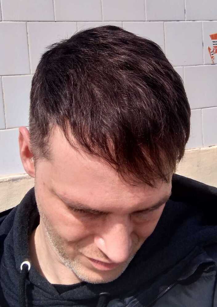 YXKxlGI.jpg