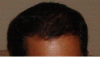 hair.GIF