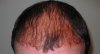 redhead.jpg