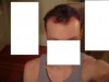 -Hairline-.JPG