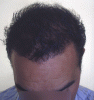 12_image417[1].gif