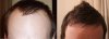 Lucky before &amp; 11 months.JPG