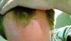 hairline1.JPG