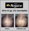 rogaine.jpg