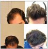 My Hair.jpg My Hair.jpg