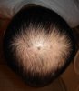 today3(crown).jpg today3(crown).jpg