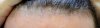 hairline_closeup.jpg hairline_closeup.jpg
