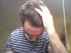 Baldingblog 7.JPG