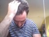 Balding blog 6.JPG