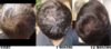 crown1dry.png
