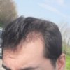 5 MONTHS (20 WEEKS) - Left.jpg