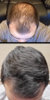 Before and After.jpg