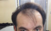 now hair 1.jpg