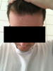 Front.png