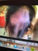 Alopecia Before.jpg