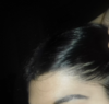 Hairline & Temple - Dry Hair.png