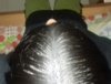 Top Front Scalp - Wet Hair.jpg