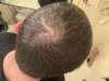 bald4.jpg