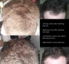 haarstatus.jpg